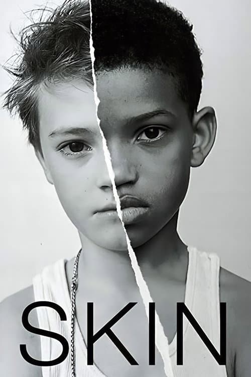 Skin afişi