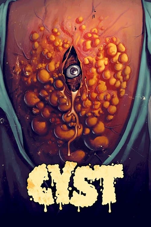 Cyst afişi